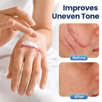 SEAGRIL® Texture Repair Gel