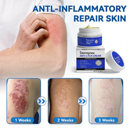👉 Official Store: Dermynex®️ PCA-Magnesium Herbal Intimate – Multi‑Purpose Relief for Scalp Itching, Eczema, Jock Itch, Facial Acne & Fungal Infections | Herbal Extracts, Steroid‑Free, No Artificial Fragrances, Gentle for All Skin Types【Tax Free】