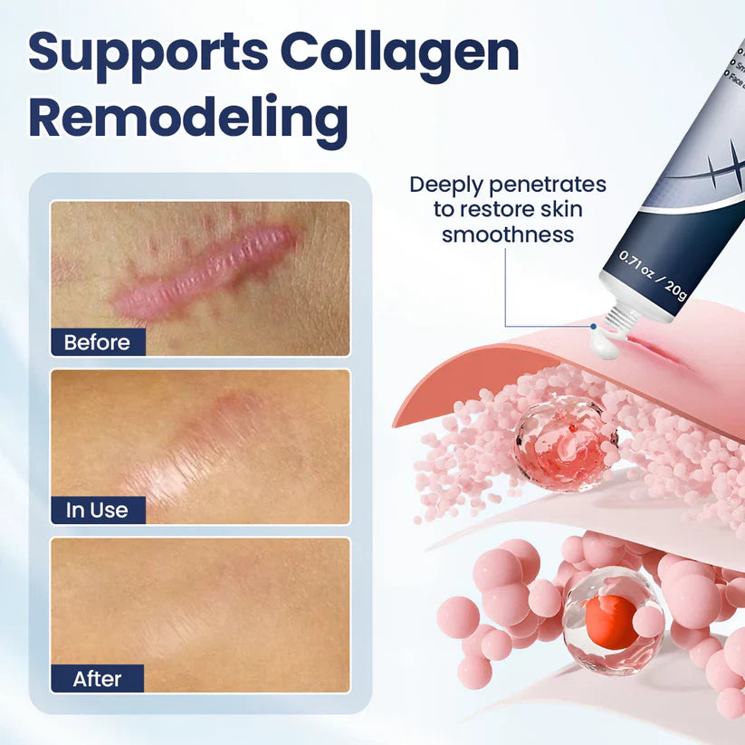 SEAGRIL® Texture Repair Gel