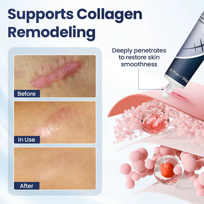 SEAGRIL® Texture Repair Gel